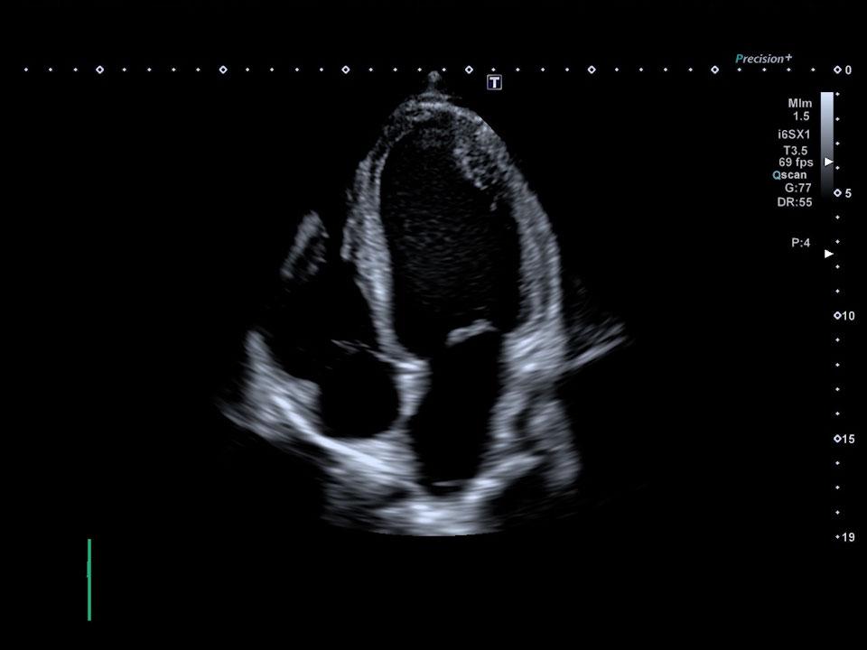 Unlabeled ultrasound image challenge number one