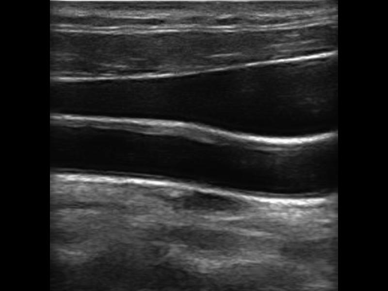 Unlabeled ultrasound image challenge number five