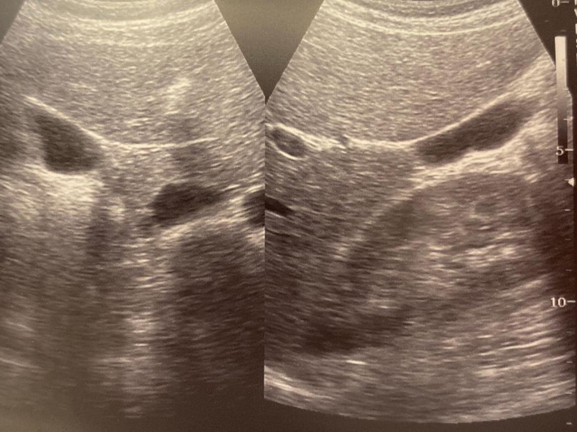 Unlabeled ultrasound image challenge number two