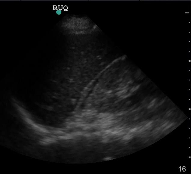 Unlabeled ultrasound image challenge number three