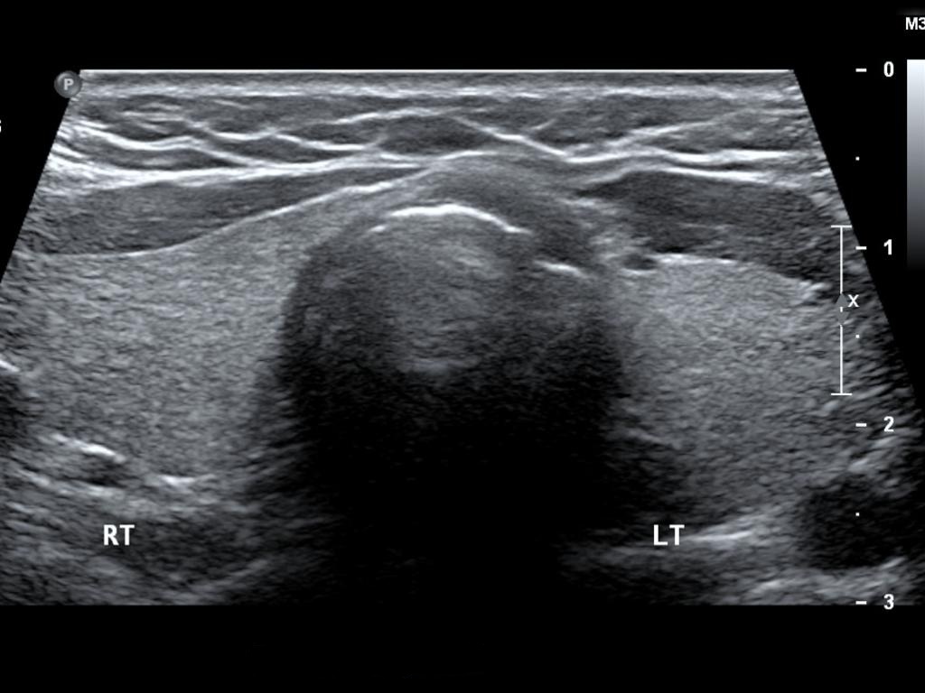Unlabeled ultrasound image challenge number four